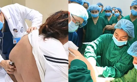 Mổ lấy thai cho sản phụ Phú Thọ nặng 178kg, không thể gây tê tủy sống vì lớp mỡ dày hơn 11cm