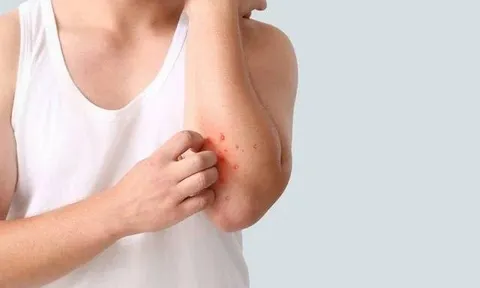 Người đàn ông 40 tuổi phát hiện ung thư gan giai đoạn cuối: Đáng tiếc ông đã bỏ qua dấu hiệu suốt 3 tháng