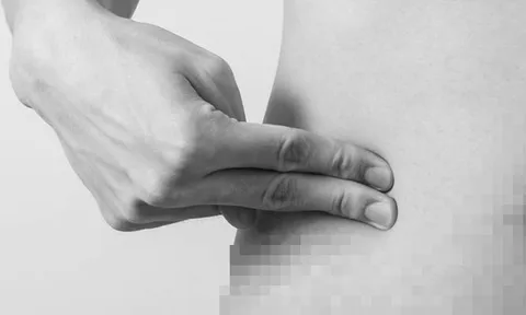 Đau bụng âm ỉ, người đàn ông suýt mất mạng vì thứ "đáng sợ" bên trong