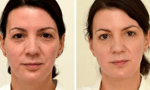 Thử nghiệm uống đủ lượng nước này trong 4 tuần, người phụ nữ 4x trẻ ra 10 tuổi