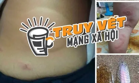 Thực hư thông tin bé 3 tuổi bị sâu biển cắn nguy kịch, gia đình tha thiết kêu gọi hỗ trợ máu hiếm