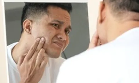 Triệu chứng ban đầu của bệnh tiểu đường có thể xuất hiện trên mặt: Thấy 7 dấu hiệu này, hãy đi khám ngay