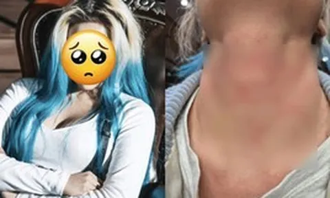 Nữ ca sĩ bị hành hung nghiêm trọng, còn bị ép viết thư xin lỗi