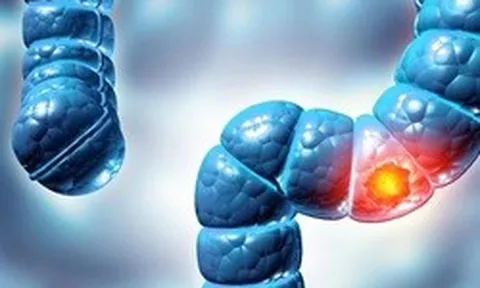 Phát hiện virus mới liên quan loại bệnh ung thư phổ biến