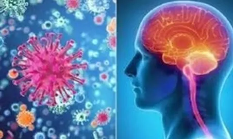 Khống chế thành công ổ dịch viêm não mô cầu ở Cà Mau