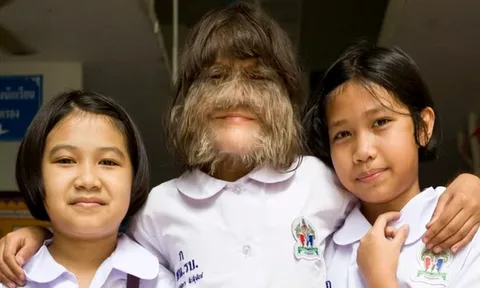 "Cô bé người sói" và hành trình phía sau khiến nhiều người nghẹn lòng