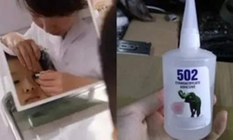 Cậu bé 3 tuổi bắt chước bà nhưng nhỏ nhầm keo 502 vào mắt: Mẹ sơ cứu trong 15 phút, bác sĩ nói "không cần điều trị nữa"