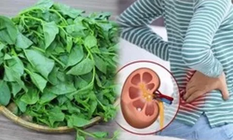 Loại rau có vị nhớt khó ăn nhưng lại được coi là "nữ hoàng" giải nhiệt mùa hè: Có 5 nhóm người tốt nhất đừng ăn nhiều
