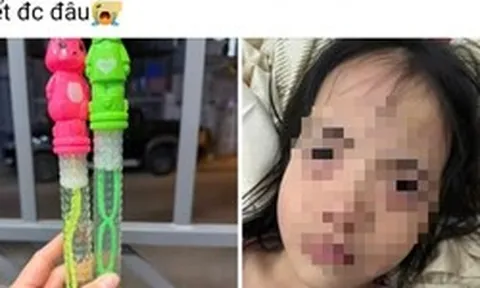 Bé gái 5 tuổi tổn thương mắt sau khi thổi bong bóng xà phòng