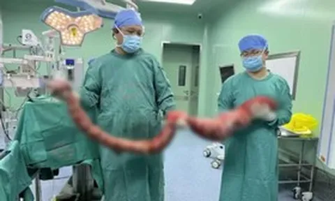 Người đàn ông 4 tháng không đi đại tiện, bụng phình to như "mang thai", bác sĩ lấy ra thứ "đáng sợ"