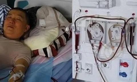 Người đàn ông 35 tuổi bị suy thận, bác sĩ thở dài: "Ngày nào cũng làm 2 việc này, thận khỏe đến đâu cũng khó chịu nổi"