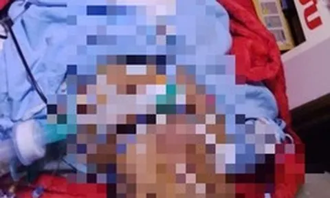 Bị bỏng nặng, mẹ đợi con thi xong tốt nghiệp THPT mới yên lòng nhắm mắt