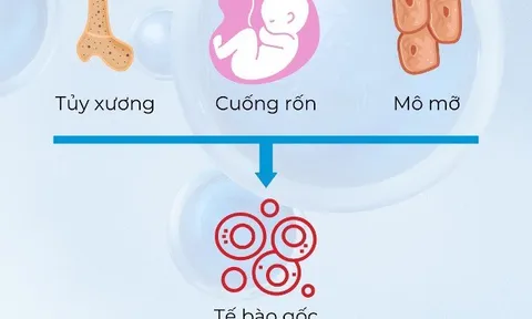 Điều trị bệnh Parkinson bằng tế bào gốc trung mô