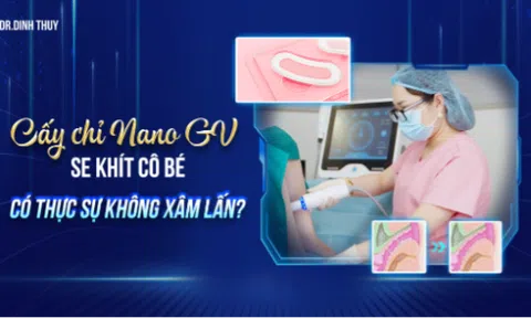 Cấy chỉ Nano GV se khít cô bé có thực sự không xâm lấn?