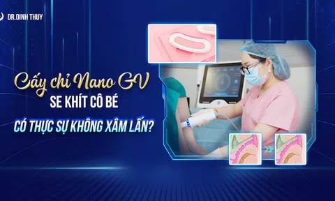 Cấy chỉ Nano GV se khít cô bé có thực sự không xâm lấn?