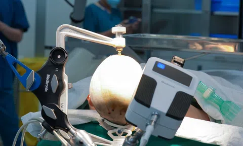 Vinmec Central Park mở lối đi mới trong điều trị động kinh bằng công nghệ Robot đỉnh cao